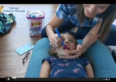Prepping for a Frenectomy