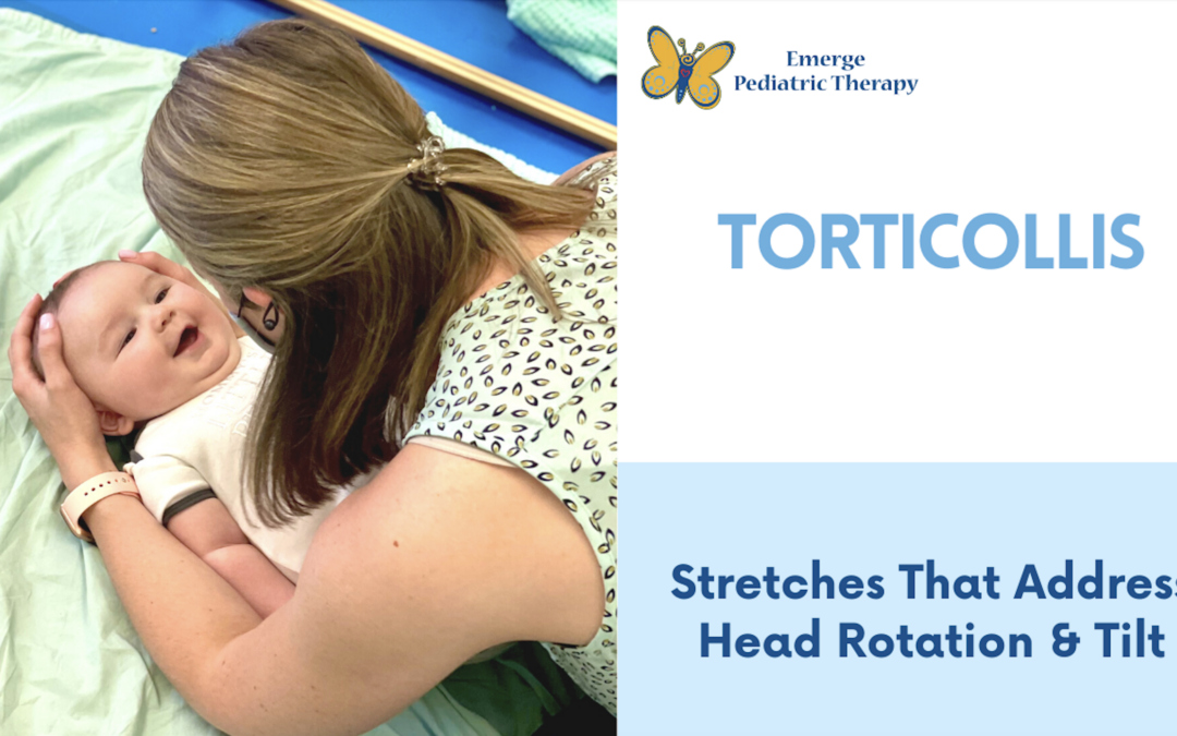 Torticollis Stretches to Try at Home