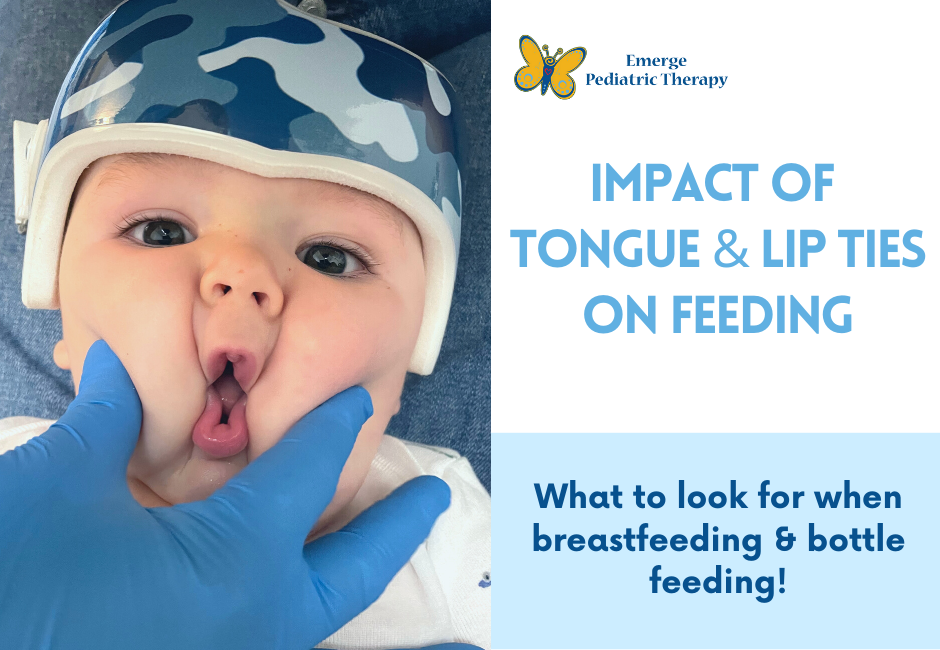 How Tongue & Lip Ties Impact Feeding