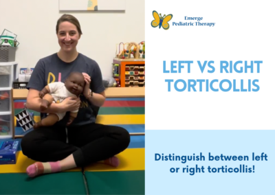Left vs. Right Torticollis